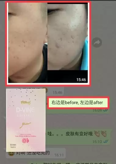 D-Vine Testimonial 17